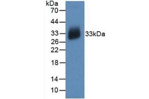 Detection of Recombinant IL12A, Human using Monoclonal Antibody to Interleukin 12A (IL12A) (IL12A anticorps  (AA 23-219))
