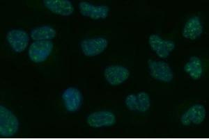 IF analysis of Tripeptidyl peptidase II/TPPII/TPP2 using anti-Tripeptidyl peptidase II/TPPII/TPP2 antibody (ABIN7601293).