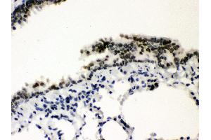 Immunohistochemistry (Paraffin-embedded Sections) (IHC (p)) image for anti-Sp3 Transcription Factor (Sp3) (AA 569-599), (C-Term) antibody (ABIN3043350) (Sp3 anticorps  (C-Term))