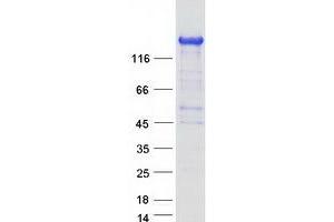 Validation with Western Blot