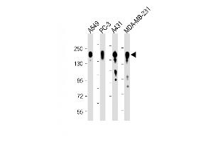 All lanes : Anti-EGFR Antibody (C-term) at 1:8000 dilution Lane 1: A549 whole cell lysate Lane 2: PC-3 whole cell lysate Lane 3: A431 whole cell lysate Lane 4: MDA-MB-231 whole cell lysate Lysates/proteins at 20 μg per lane. (EGFR anticorps  (C-Term))