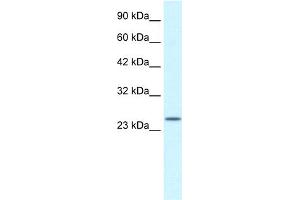 WB Suggested Anti-ZA20D3 Antibody Titration:  2. (ZFAND6 anticorps  (Middle Region))