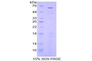 SDS-PAGE (SDS) image for Nestin (NES) (AA 197-462) protein (His tag,GST tag) (ABIN2123358)