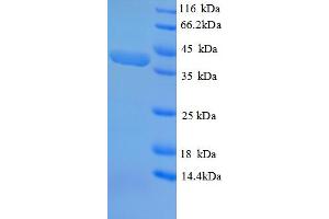 SDS-PAGE (SDS) image for SPEG Complex Locus (SPEG) (AA 1-113), (partial) protein (GST tag) (ABIN5710410)