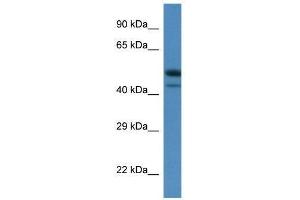 Western Blot showing Sbk1 antibody used at a concentration of 1. (SBK1 anticorps  (C-Term))