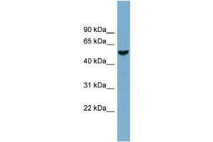 WB Suggested Anti-FAM83E  Antibody Titration: 0. (FAM83E anticorps  (Middle Region))