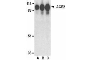 Western blot analysis of ACE2 in human kidney lysate with AP30006PU-N ACE2 antibody at (A) 0. (ACE2 anticorps  (Intermediate Domain 1))