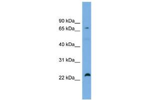 WB Suggested Anti-SPG20  Antibody Titration: 0. (SPG20 anticorps  (Middle Region))