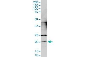 CCDC12 monoclonal antibody (M05), clone 7B1. (CCDC12 anticorps  (AA 1-166))