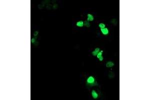 Anti-ATRIP mouse monoclonal antibody (ABIN2455756) immunofluorescent staining of COS7 cells transiently transfected by pCMV6-ENTRY ATRIP (RC223562). (ATRIP anticorps  (AA 42-309))