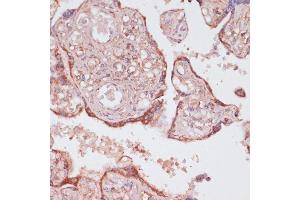 Immunohistochemistry of paraffin-embedded human placenta using C1 antibody (ABIN7265723) at dilution of 1:100 (40x lens).