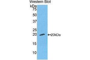 Figure. (ENPP1 anticorps  (Biotin))
