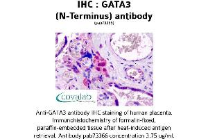 Image no. 2 for anti-GATA Binding Protein 3 (GATA3) (N-Term) antibody (ABIN1734640) (GATA3 anticorps  (N-Term))