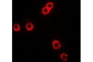 Immunofluorescent analysis of CD281 staining in Hela cells. (TLR1 anticorps)