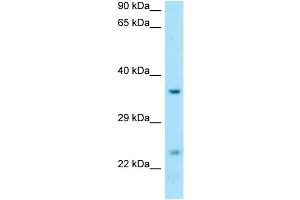 WB Suggested Anti-DTD1 Antibody Titration: 1. (DTD1 anticorps  (C-Term))