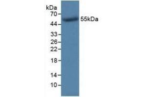 Detection of Recombinant TK1, Human using Monoclonal Antibody to Thymidine Kinase 1, Soluble (TK1) (TK1 anticorps  (AA 2-234))