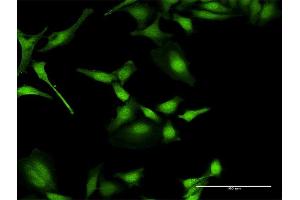 Immunofluorescence of purified MaxPab antibody to PIP5K1A on HeLa cell.