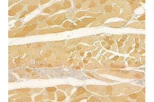 ABIN6262391 and ABIN6269042 at 1/100 staining human tongue carcinoma by IHC-P.