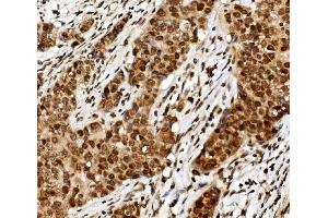 IHC analysis of TIF1 gamma/TRIM33 using anti TIF1 gamma/TRIM33 antibody (ABIN7599621). (TRIM33 anticorps  (AA 1001-1127))