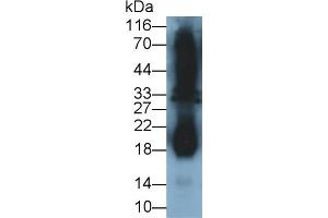 Detection of IFNg in Cavia Testis lysate using Polyclonal Antibody to Interferon Gamma (IFNg) (Interferon gamma anticorps  (AA 24-166))