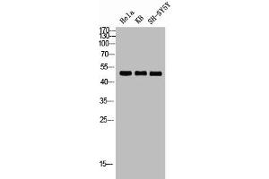 Western blot analysis of HELA KB SH-SY5Y lysis using RRS1 antibody. (RRS1 anticorps  (Internal Region))