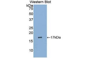 Western Blotting (WB) image for anti-Leukemia Inhibitory Factor Receptor alpha (LIFR) (AA 45-184) antibody (ABIN3208382) (LIFR anticorps  (AA 45-184))