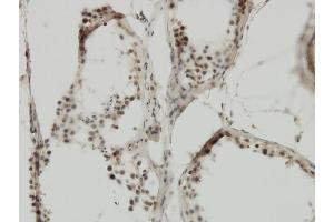 Immunoperoxidase of monoclonal antibody to TRIM24 on formalin-fixed paraffin-embedded human testis. (TRIM24 anticorps  (AA 432-569))