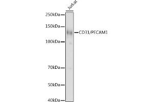 Western blot analysis of extracts of Jurkat cells, using CD31/PEC antibody (ABIN3022923, ABIN3022924, ABIN3022925 and ABIN6219299) at 1:1000 dilution.