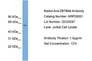 WB Suggested Anti-ZBTB46  Antibody Titration: 0. (ZBTB46 anticorps  (Middle Region))