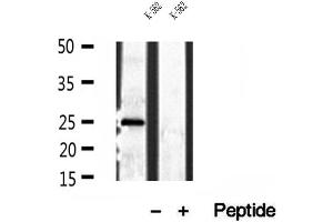 Western blot analysis of extracts of K-562 cells, using PLDN antibody. (Pallidin anticorps  (C-Term))