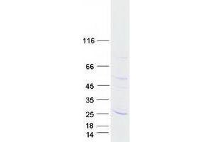 Validation with Western Blot