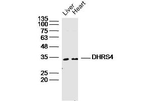 Lane 1: Mouse Liver lysates Lane 2: Mouse Heart lysates probed with DHRS4 Polyclonal Antibody, Unconjugated  at 1:300 dilution and 4˚C overnight incubation. (DHRS4 anticorps  (AA 161-278))