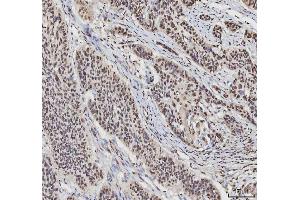 IHC analysis of hnRNP L/HNRNPL using anti-hnRNP L/HNRNPL antibody (ABIN7600130). (HNRNPL anticorps  (AA 152-569))