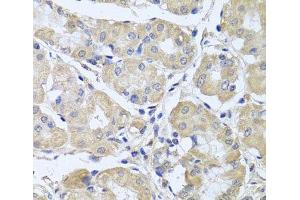 Immunohistochemistry of paraffin-embedded Human stomach using CEP57L1 Polyclonal Antibody at dilution of 1:100 (40x lens). (CEP57L1 anticorps)