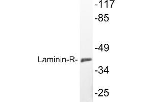 Western blot (WB) analyzes of Laminin-R antibody in extracts from K562 cells. (RPSA/Laminin Receptor anticorps)