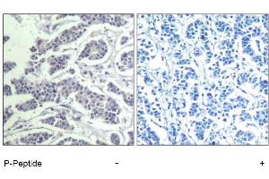 Image no. 1 for anti-V-Akt Murine Thymoma Viral Oncogene Homolog 1 (AKT1) (pTyr312), (pTyr315), (pTyr316) antibody (ABIN319269) (AKT1 anticorps  (pTyr312, pTyr315, pTyr316))