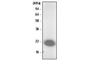 Western Blotting (WB) image for anti-Parkinson Protein 7 (PARK7) antibody (ABIN165444) (PARK7/DJ1 anticorps)