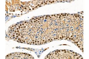 ABIN6256382 and ABIN6267095 at 1/100 staining Mouse testis tissue by IHC-P.