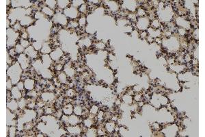 ABIN6278250 at 1/100 staining Mouse lung tissue by IHC-P. (UBE2M anticorps  (Internal Region))