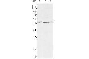 Western blot analysis using DKK3 mouse mAb against HEK293 (1), MCF-7 (2) and HL7702 (3) cell lysate. (DKK3 anticorps)