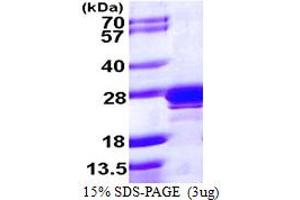 SDS-PAGE (SDS) image for RAB2A, Member RAS Oncogene Family (RAB2A) (AA 1-212) protein (His tag) (ABIN667923)