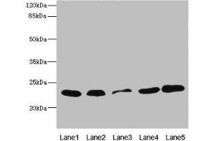 Western blot All lanes: TIMM23 antibody at 3. (TIMM23 anticorps  (AA 1-209))