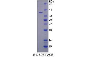 SDS-PAGE (SDS) image for Cytochrome C Oxidase Subunit VIc (COX6C) (AA 1-75) protein (His tag,GST tag) (ABIN6239477) (COX6C Protein (AA 1-75) (His tag,GST tag))