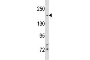 TSC2 antibody western blot analysis in NCI-H292 lysate.