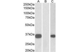 Western Blotting (WB) image for anti-Kv Channel Interacting Protein 3, Calsenilin (KCNIP3) (N-Term) antibody (ABIN1105647) (DREAM anticorps  (N-Term))