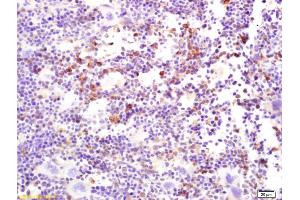 Formalin-fixed and paraffin embedded mouse spleen labeled with Rabbit Anti C-Mer/MERTK Polyclonal Antibody, Unconjugated (ABIN669966) at 1:200 followed by conjugation to the secondary antibody and DAB staining (MERTK anticorps  (AA 501-600))