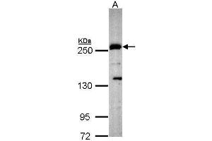 WB Image Sample (30 ug of whole cell lysate) A: Hep G2 , 5% SDS PAGE antibody diluted at 1:1000 (PLXND1 anticorps  (C-Term))
