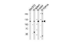 Western blot analysis of lysates from mouse NIH/3T3 cell line, mouse spleen, mouse testis, mouse thymus tissue lysate (from left to right), using Trim24 Antibody (C-term) (ABIN6244019 and ABIN6577664). (TRIM24 anticorps  (C-Term))