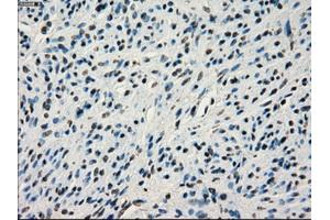 Immunohistochemistry (IHC) image for anti-Interferon Regulatory Factor 3 (IRF3) antibody (ABIN1498899) (IRF3 anticorps)