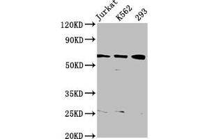 Western Blot Positive WB detected in: Jurkat whole cell lysate, K562 whole cell lysate, 293 whole cell lysate All lanes: ELP3 antibody at 3. (ELP3/KAT9 anticorps  (AA 1-85))